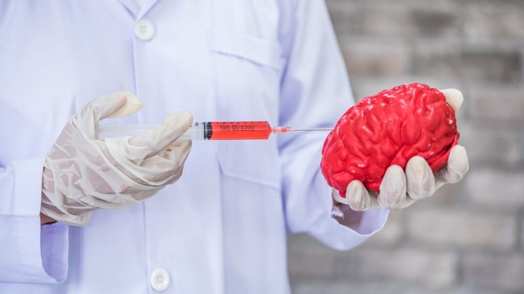 7 Brain Aneurysm Treatment Options: Fast Facts for All Types of Aneryseum 2 image 7244 LIV Hospital