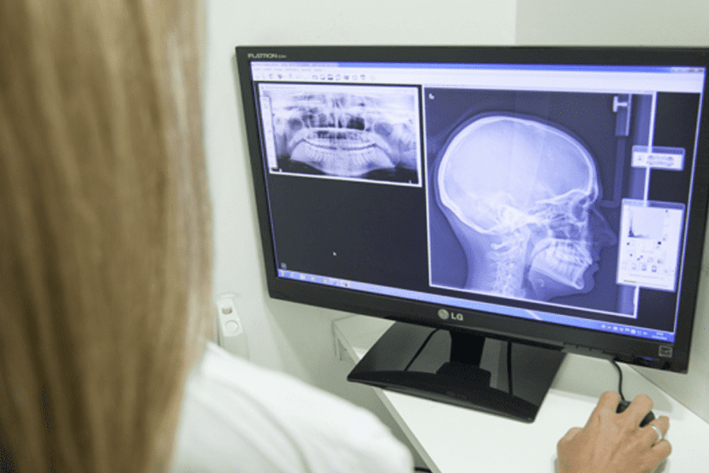 Xray and CT Scan Difference: 7 Key Facts Doctors Want You to Know 3 Xray and CT Scan Difference: 7 Key Facts Doctors Want You to Know