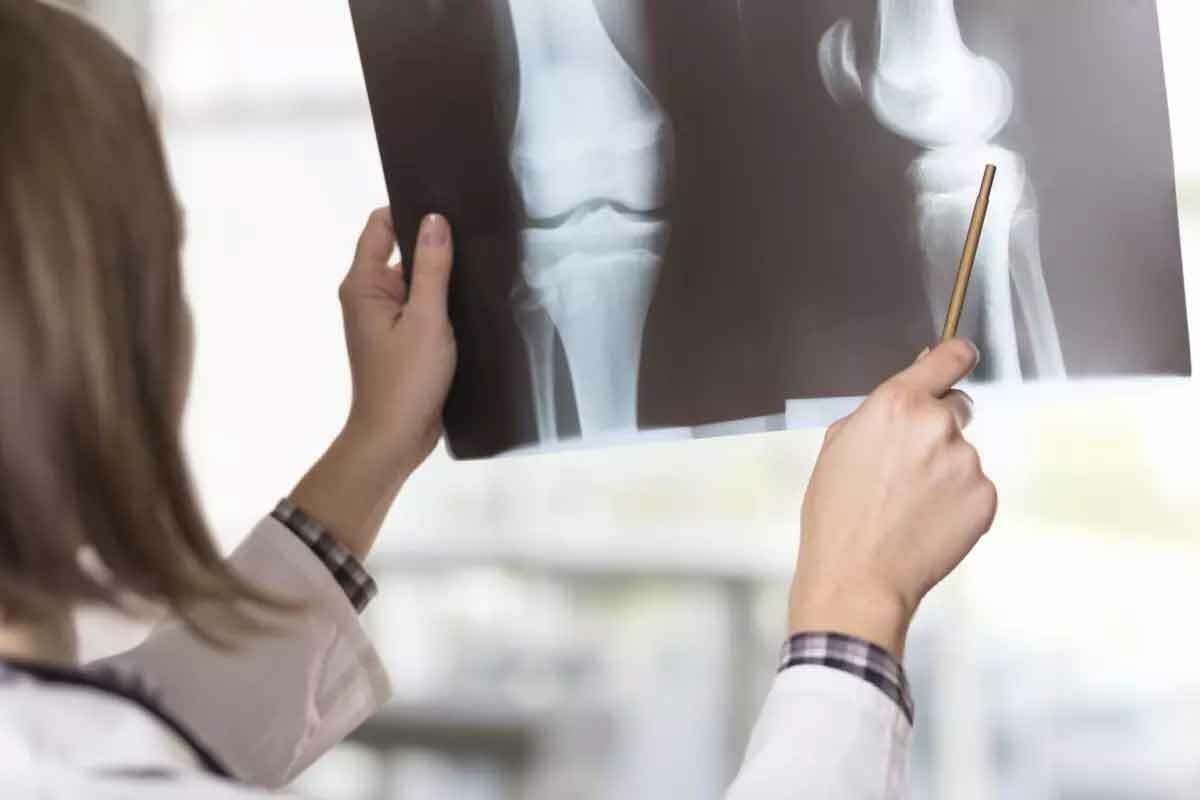 Bone Scintigraphy: How a Bone Scan Works