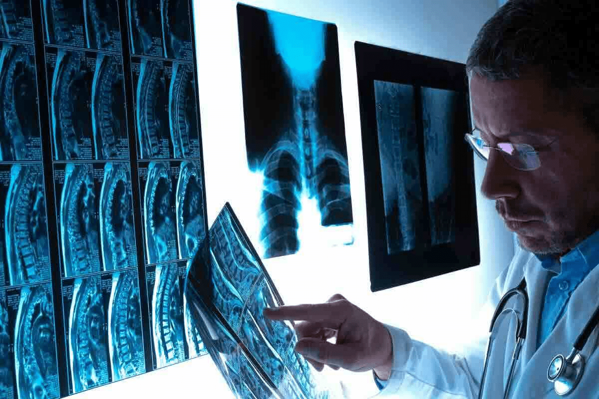 3 Phase Bone Scan Radiology: 7 Key Facts