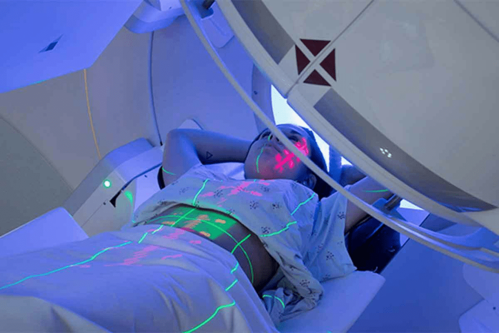 Can You Have Radiation Therapy More Than Once? 1 Can You Have Radiation Therapy More Than Once?