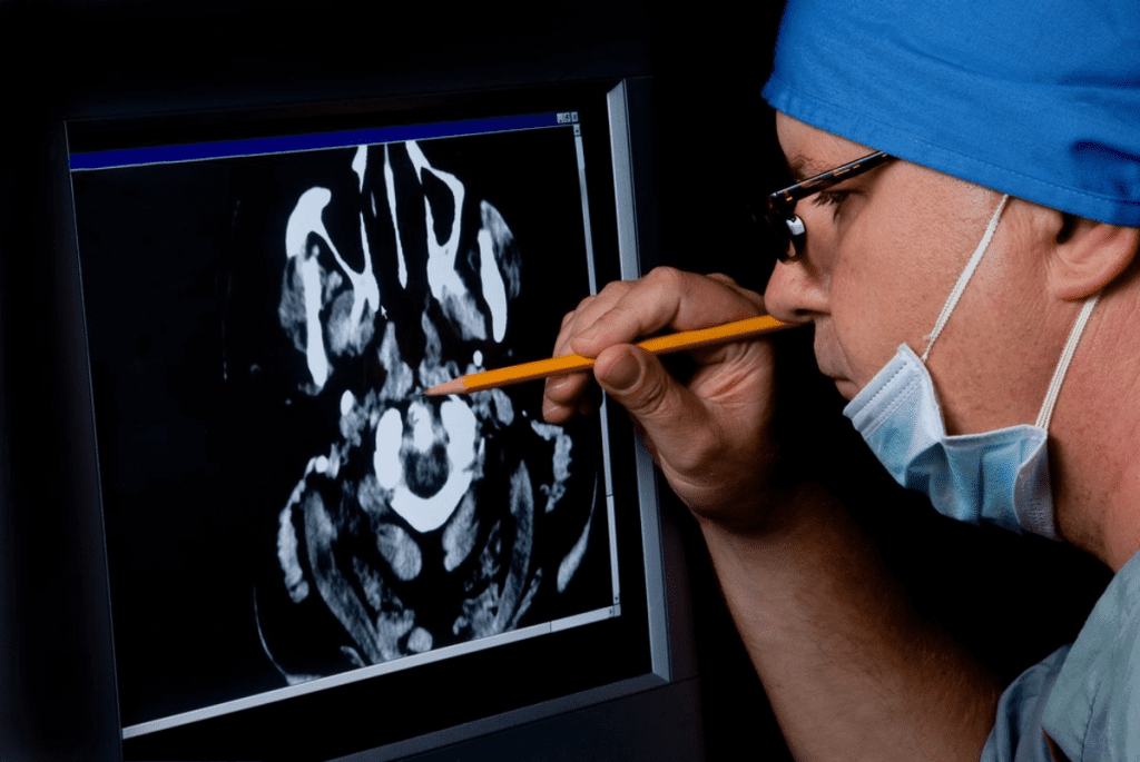 Brain Cancer CT Scan: Detection Facts 2 Brain Cancer CT Scan: Detection Facts