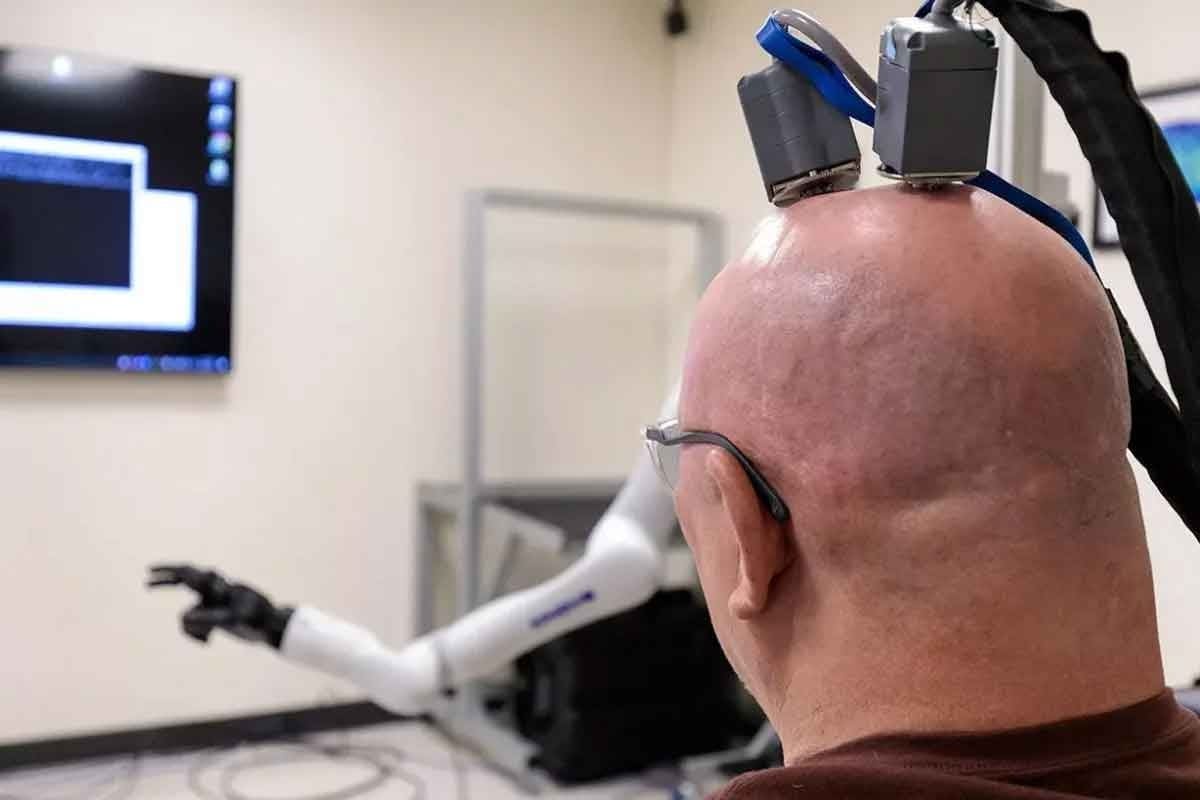 Cerebral Embolisation: 7 Key Facts About Brain Embolization Procedures