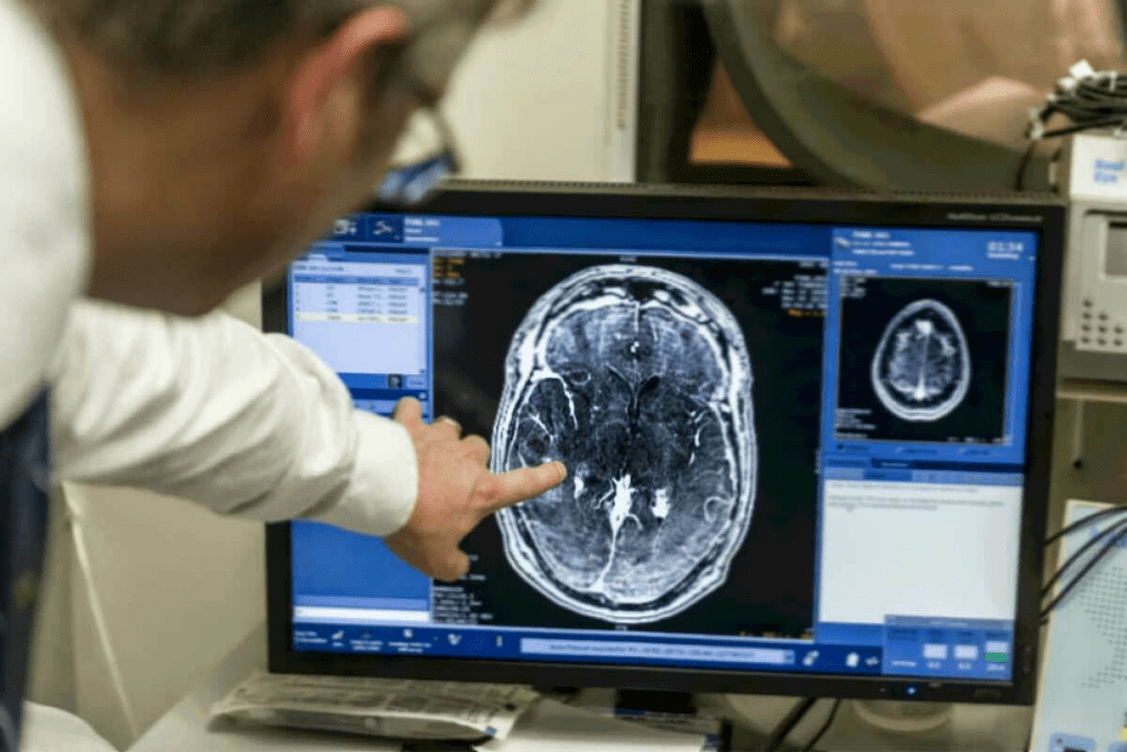 Small Brain Tumor MRI Images: 7 Key Insights