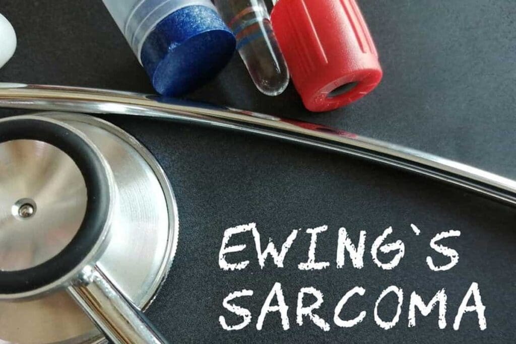 Ewings Disease: 7 Key Facts About Ewing Sarcoma