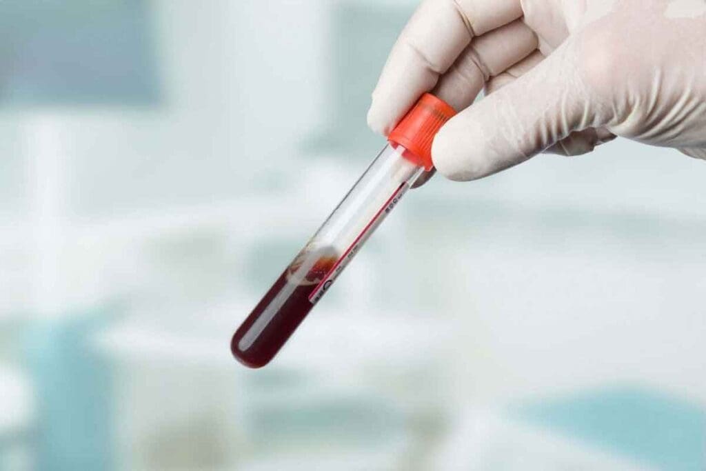 A Hemoglobin Concentration in Sickle Cell Disease: 7 Key Facts