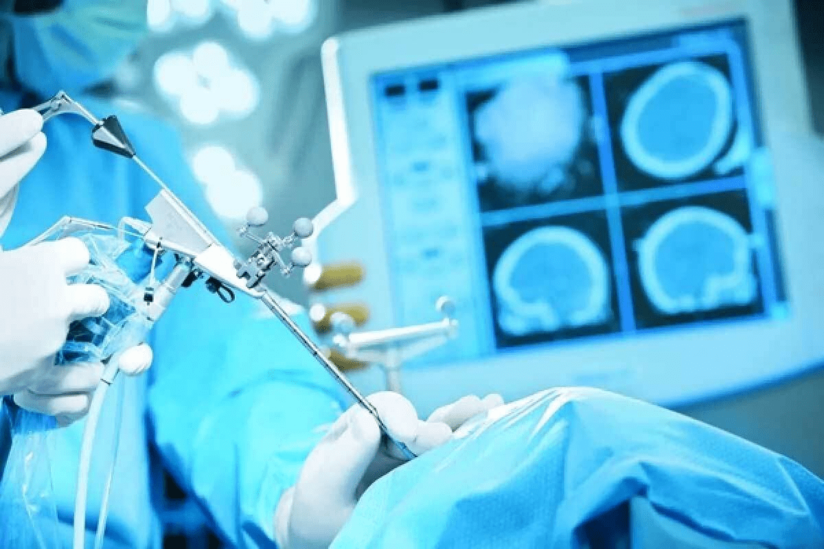 Brain Tumor Removal: Step-by-Step Guide