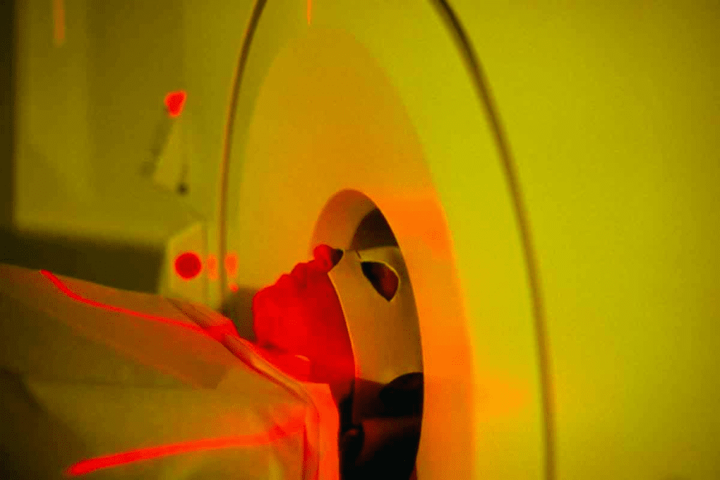 Depressed Brain PET Scan: Essential Differences from Normal Brains