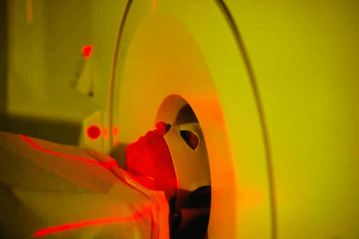 Depressed Brain PET Scan: Essential Differences from Normal Brains