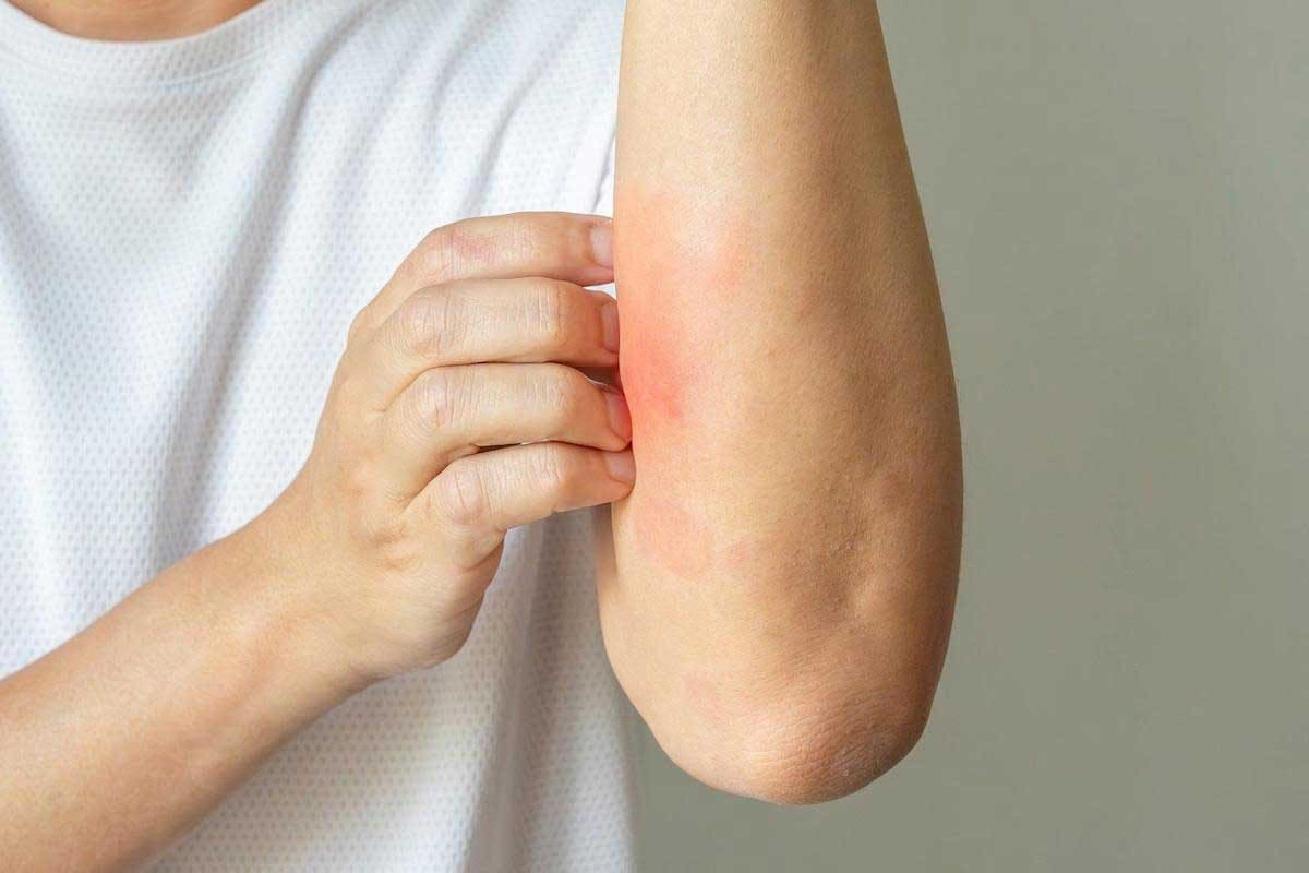 Petechiae Itchy: 8 Common Causes
