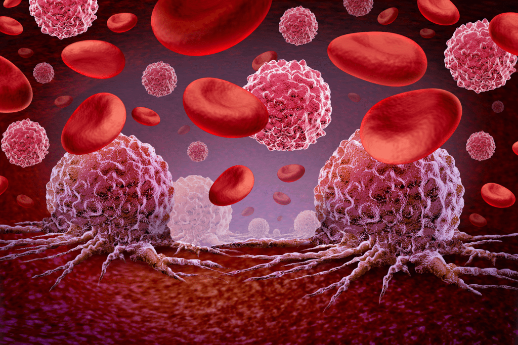 Early Signs of Leukemia in Blood Work: Crucial Test