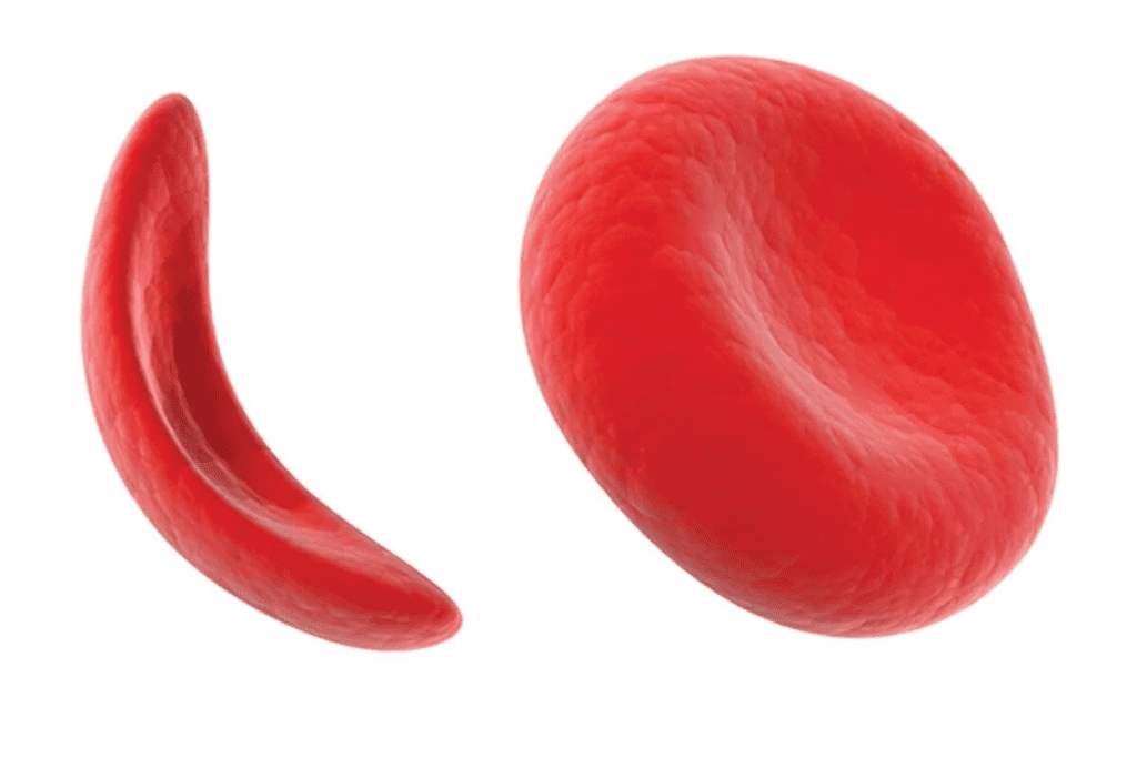 Anemia: How to Raise a Low Blood Count Powerfully