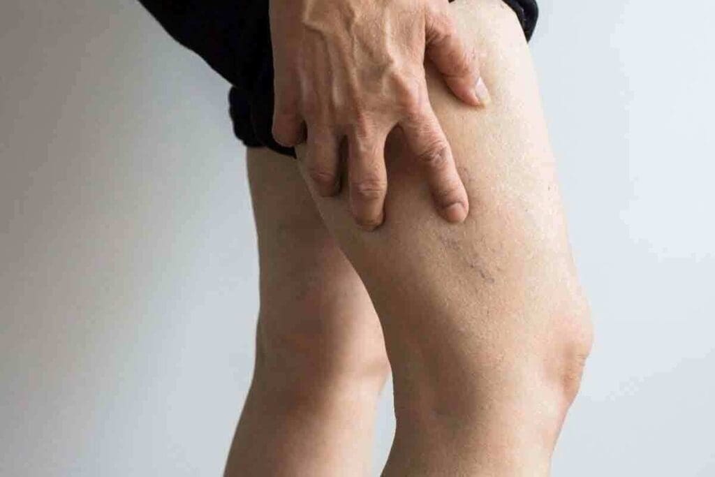 Can You Get Deep Vein Thrombosis (DVT) in Your Arm or Shoulder? Symptoms, Risks, and What to Do 1 Can You Get Deep Vein Thrombosis (DVT) in Your Arm or Shoulder? Symptoms, Risks, and What to Do