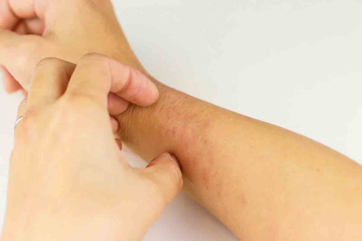 Bruising and Itchy Skin: Causes Explained