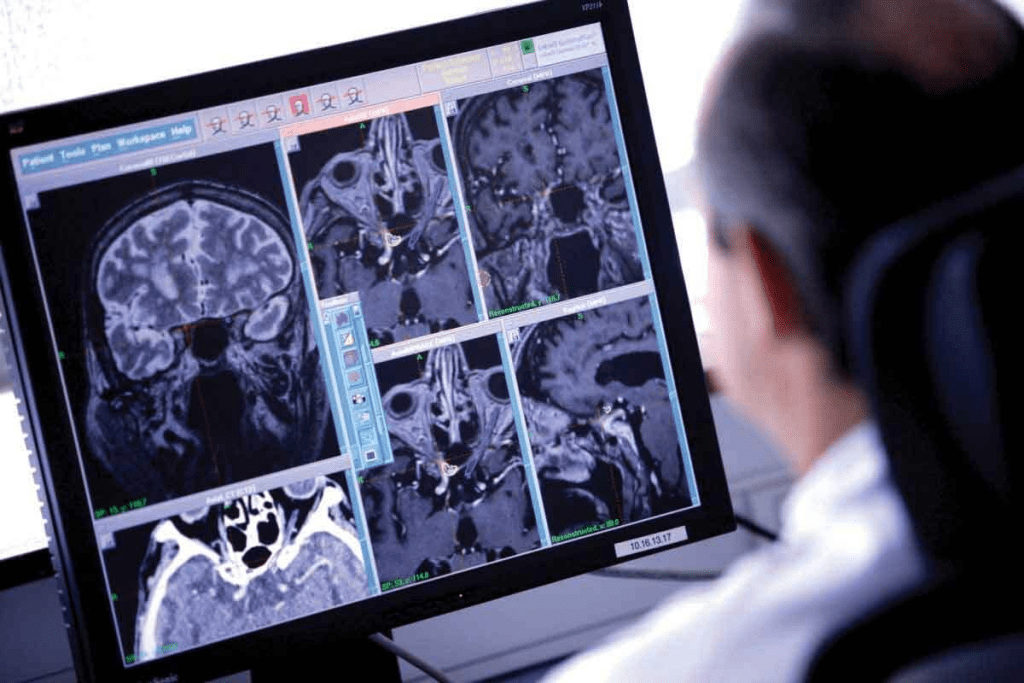 Can Brain Tumor Be Cured? Survival Facts 3 Can Brain Tumor Be Cured? Survival Facts