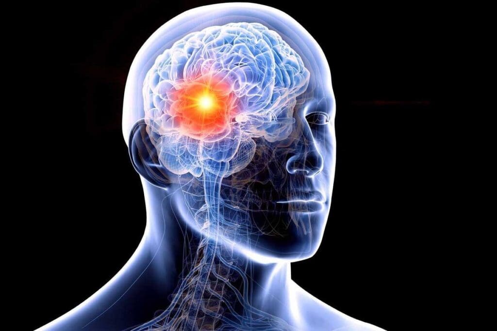 Prognosis and Survival Rates for Grade 3 Primary Brain Cancer