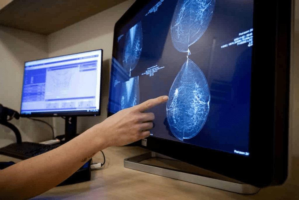 What Is the Best Scan to Detect Cancer? Top Imaging Choices 2 What Is the Best Scan to Detect Cancer? Top Imaging Choices