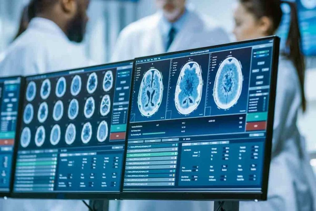 How Accurate Is CT Scan for Brain Tumor?