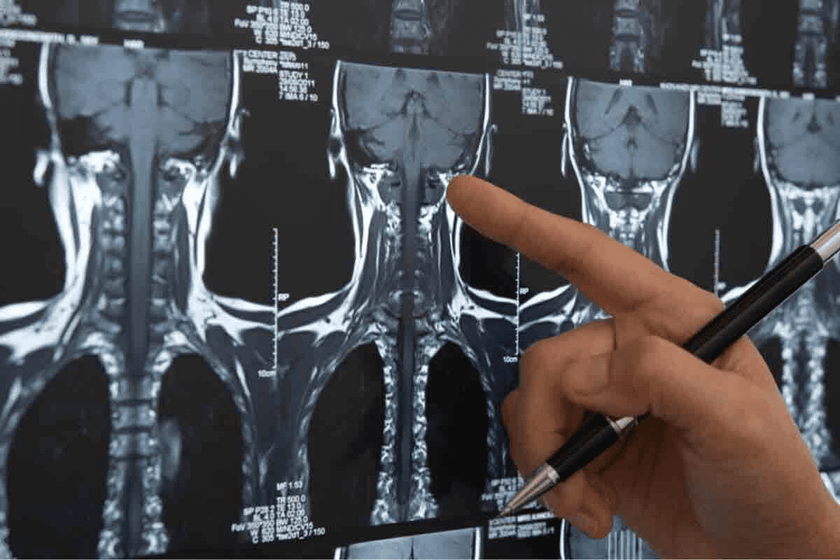 CT Scan of Neck Soft Tissue With Contrast: 7 Essential Facts