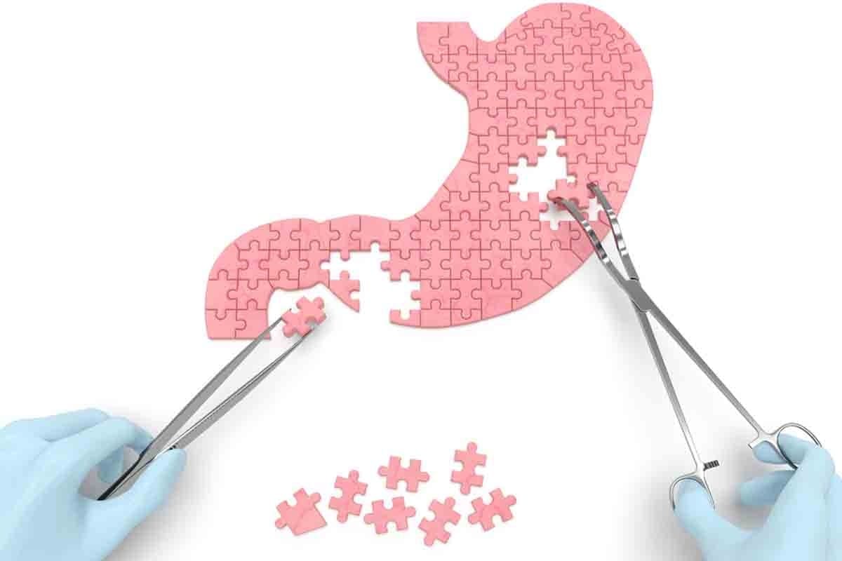 After Stomach Surgery Exercises: 10 Essential Safe Moves