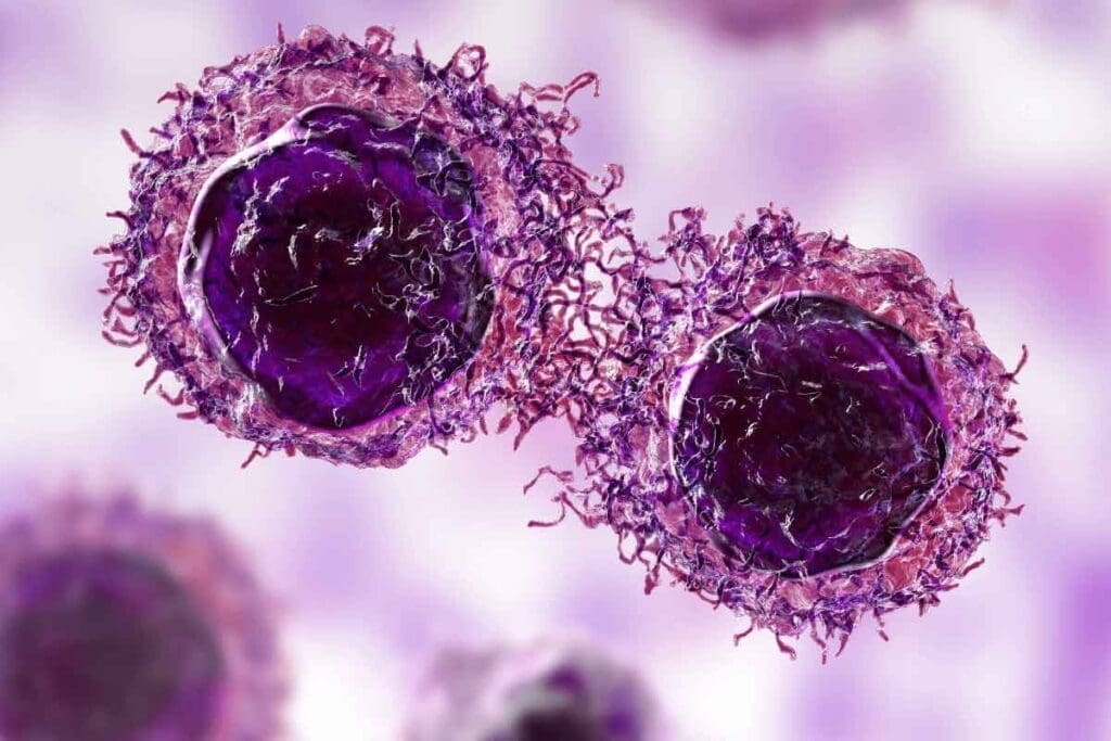 Ewing Sarcoma Cancer: Causes & Symptoms 2 Ewing Sarcoma Cancer: Causes & Symptoms