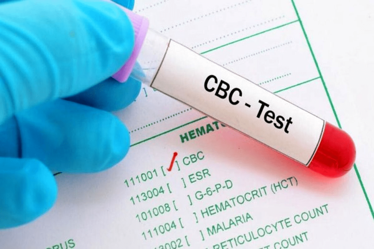 CBC Infection Detection: A Powerful Way to Spot Disease