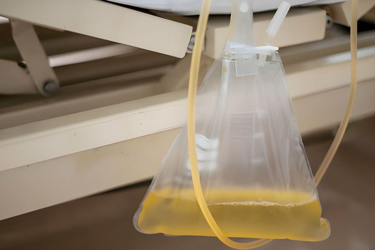 Biliary Drainage Color: 7 Key Facts Explained