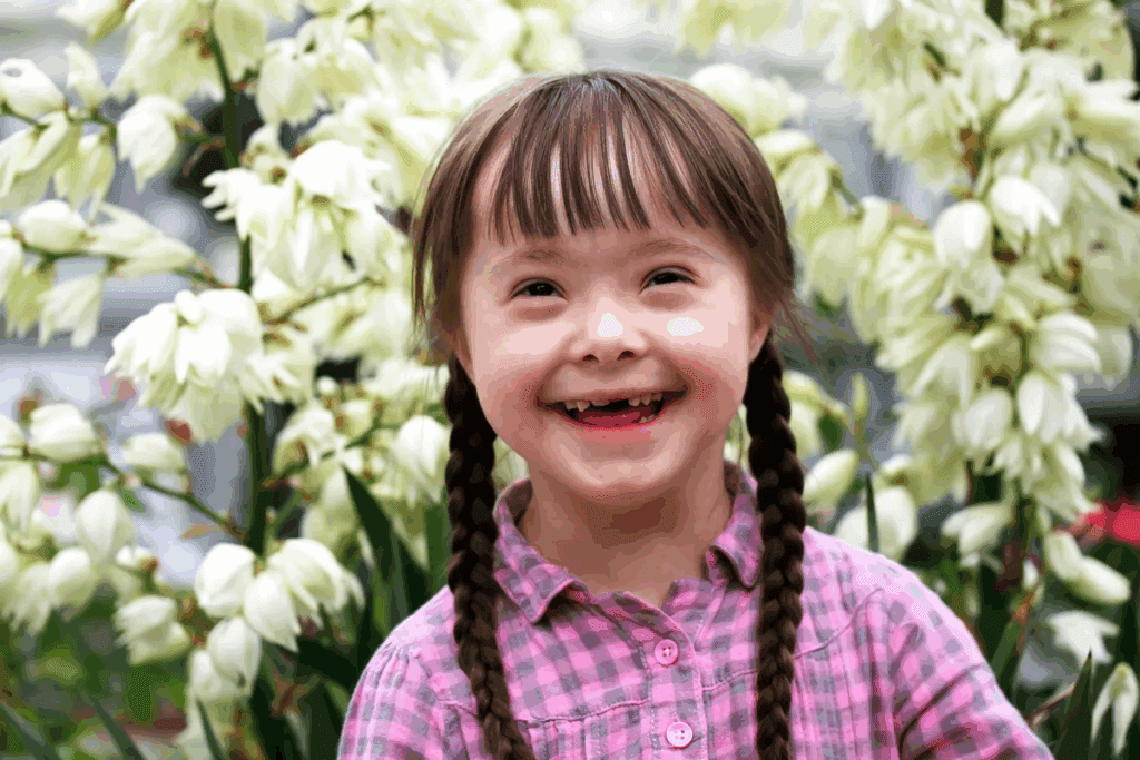 How Common Is Down Syndrome in Mothers?
