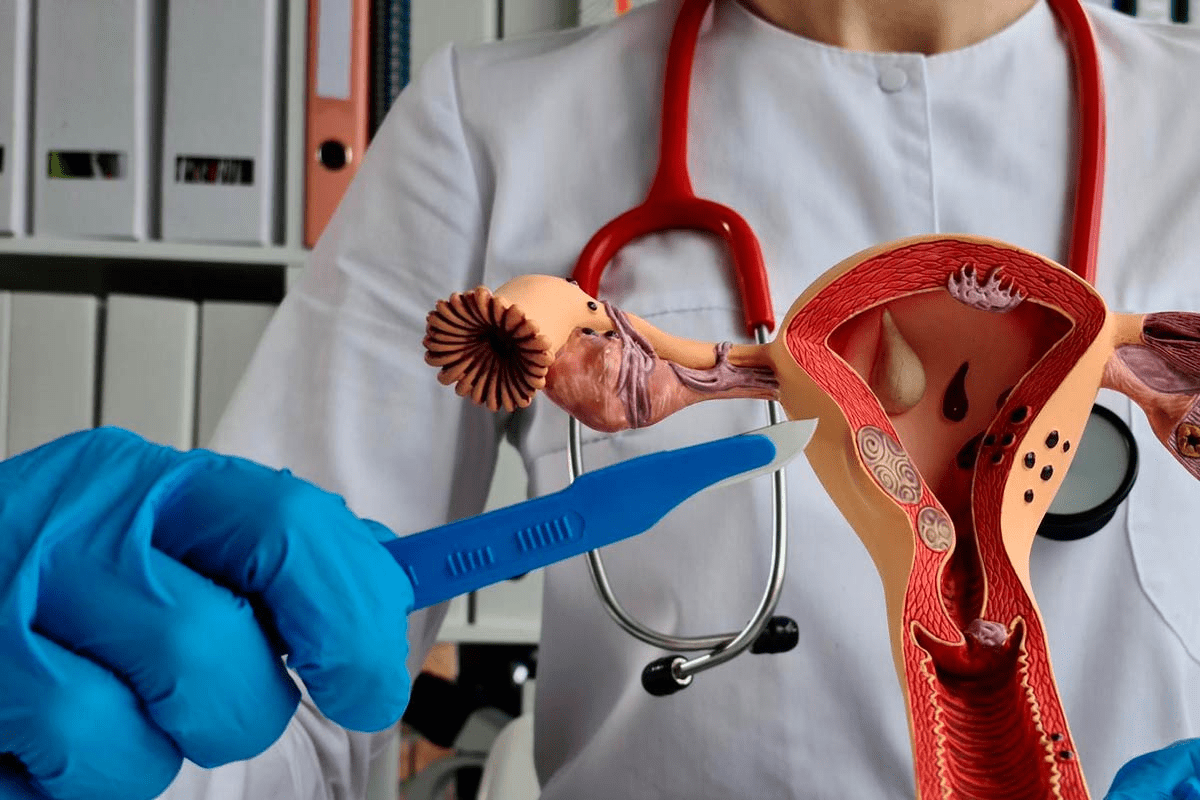 Laparoscopic Hysterectomy: Safest Option?