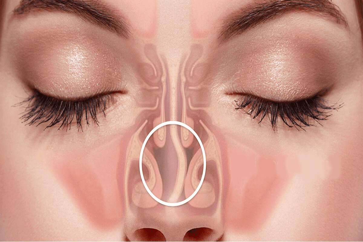 How Long Is a Sinus Infection Contagious?