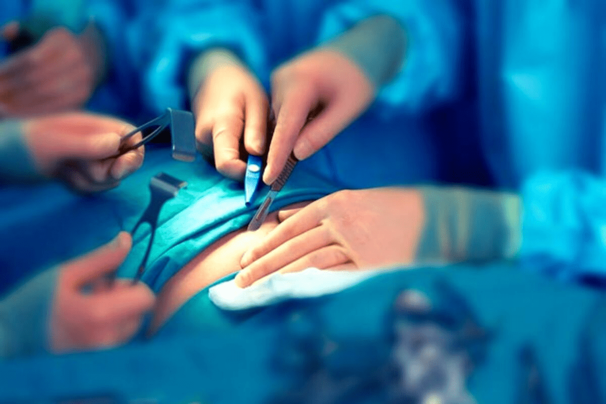 What Is Cystectomy? Medical Definition & Overview 3 What Is Cystectomy? Medical Definition & Overview