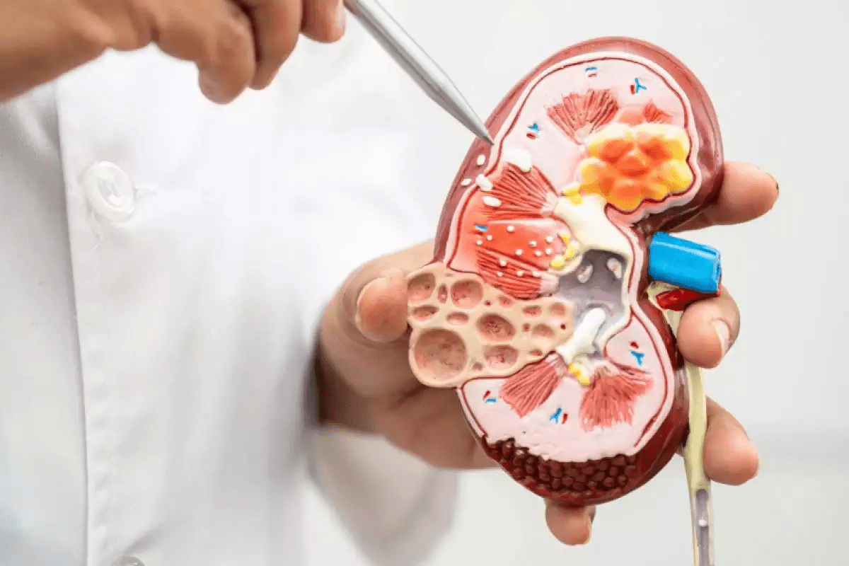 Smooth Kidney Stones: Size, Color & Growth 2 Smooth Kidney Stones: Size, Color & Growth