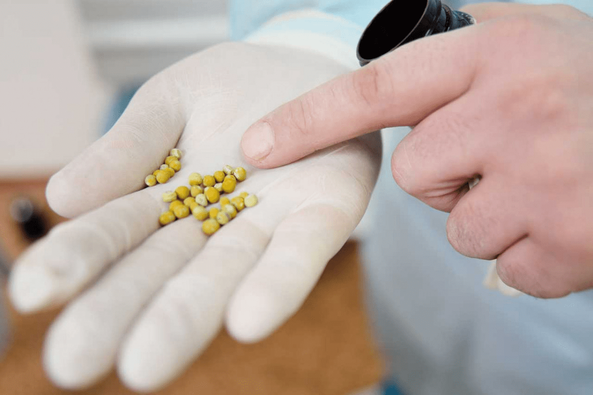 What Do Bladder Stones Look Like? Appearance & Risks