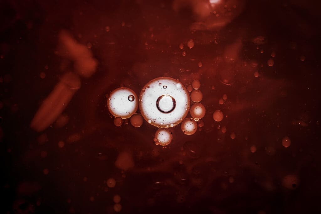 infectious coronavirus blood stain LIV Hospital