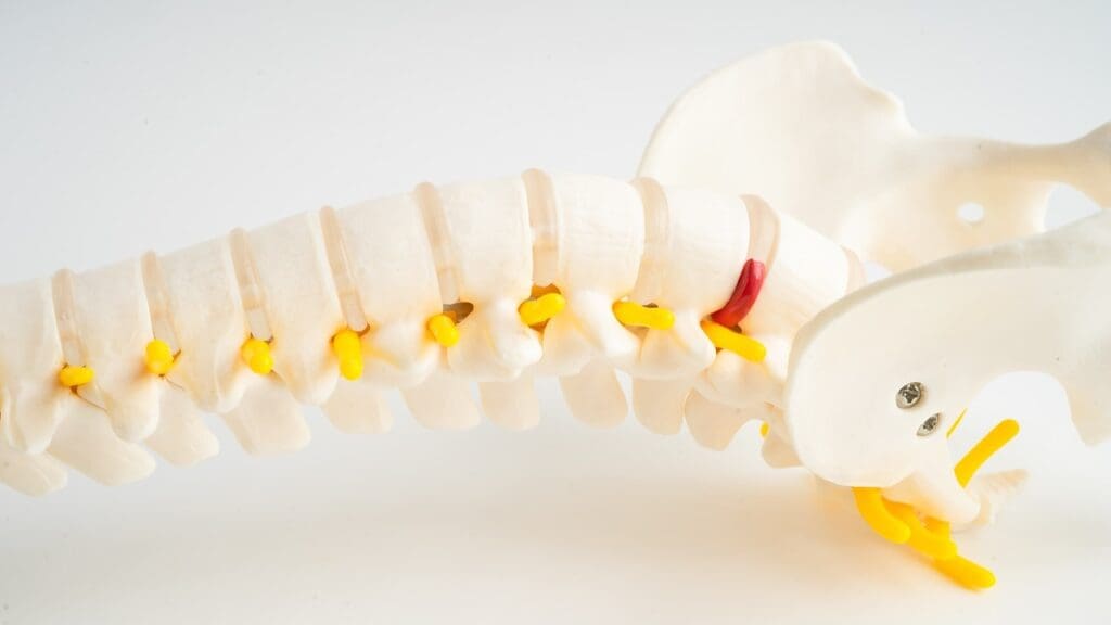 is a bulging disc the same as a slipped disc