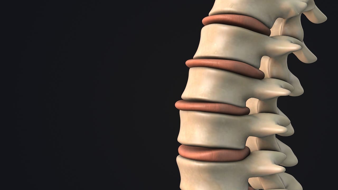 is a bulging disc the same as a slipped disc