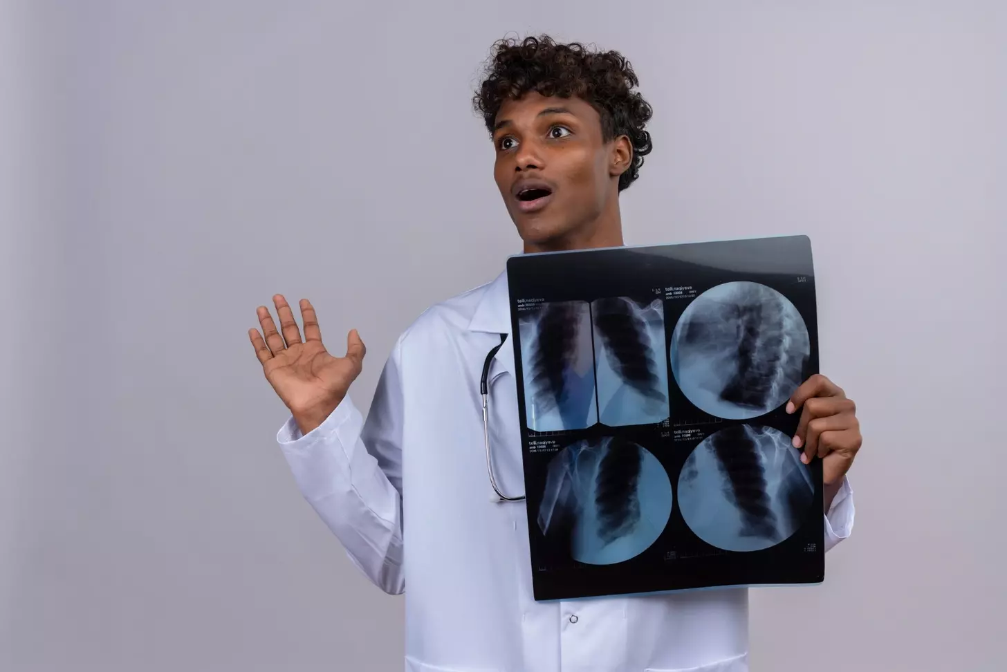 is non small cell lung cancer curable