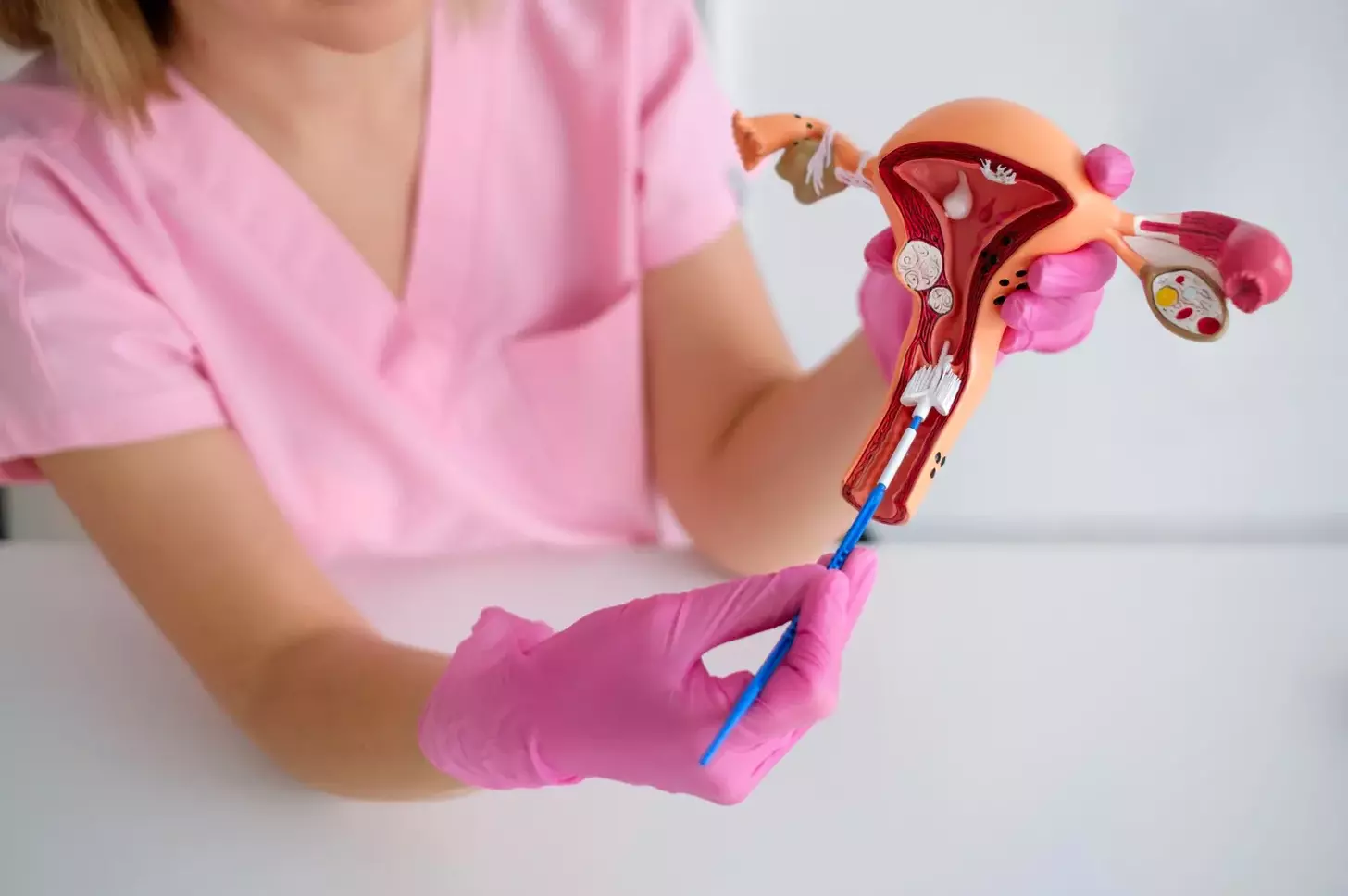 laparoscopic fibroid removal