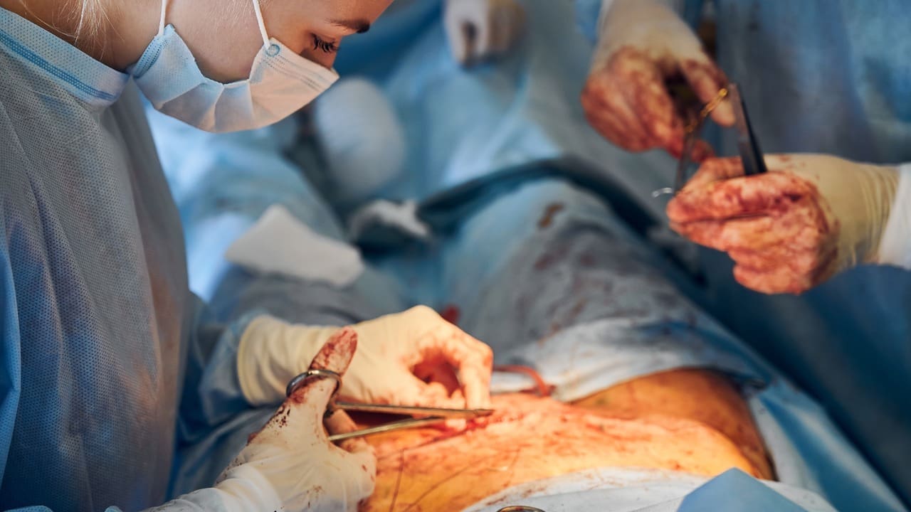 laparoscopic vs orthoscopic