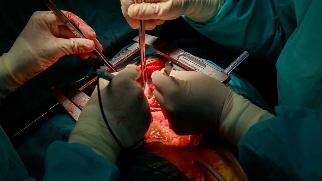 Leaking Heart Valve Replacement: 7 Key Facts About Surgery and Repair