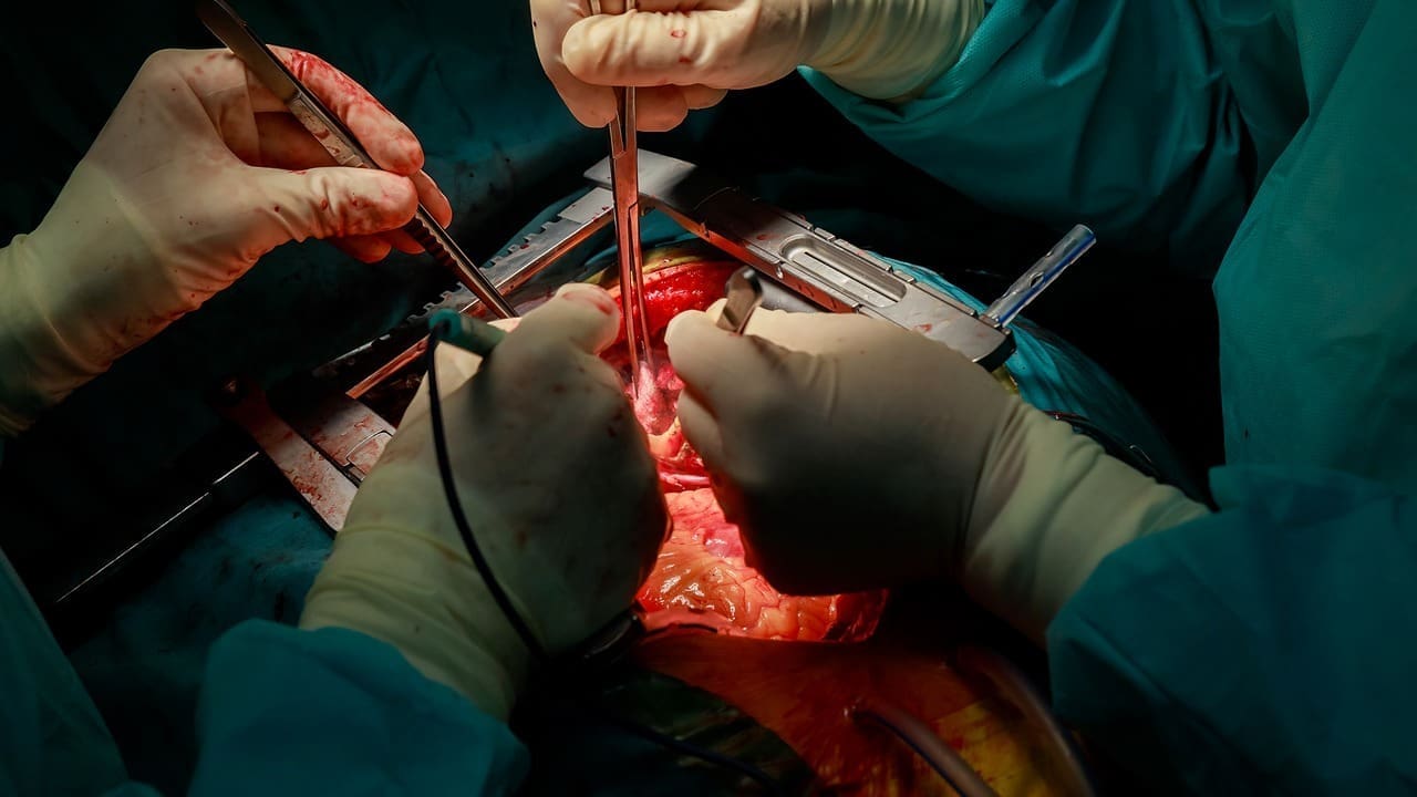 leaking heart valve replacement
