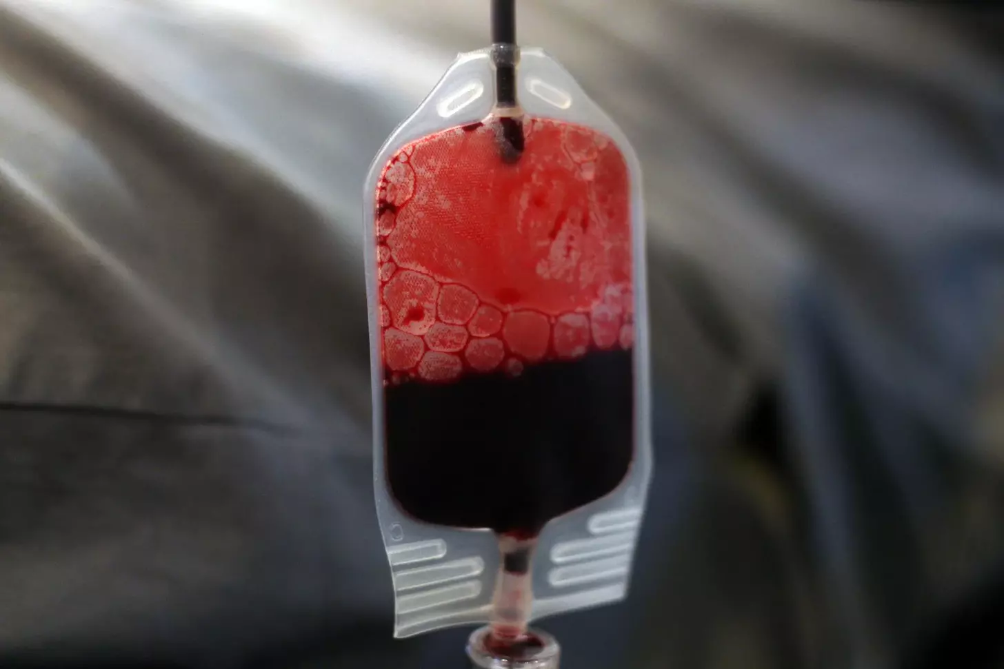 leukemia blood transfusion