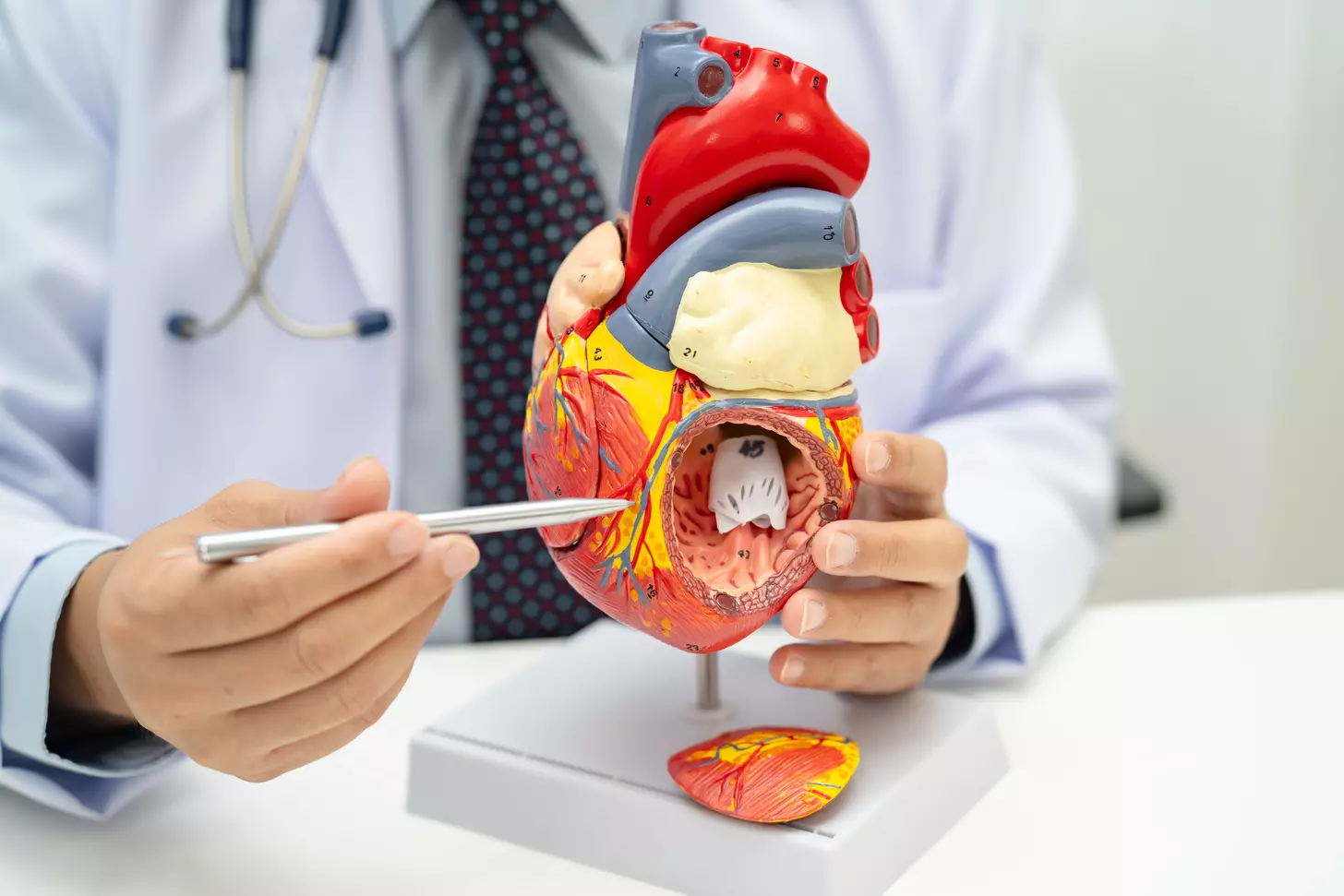lima coronary artery bypass
