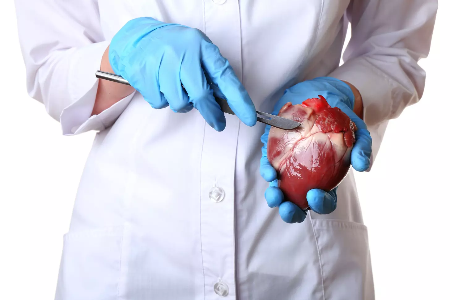 lima to lad bypass graft