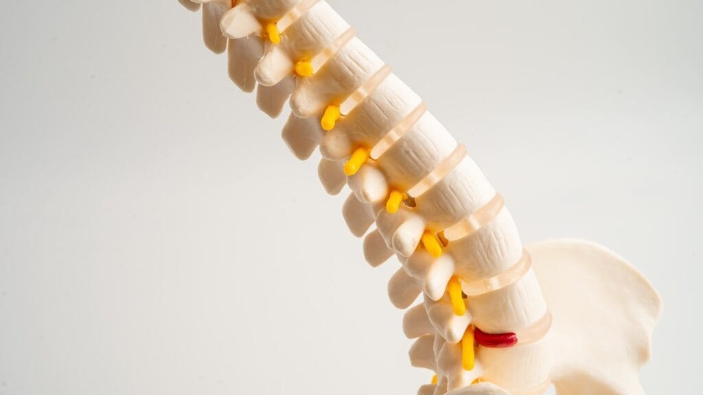 lumbar vertebral fusion