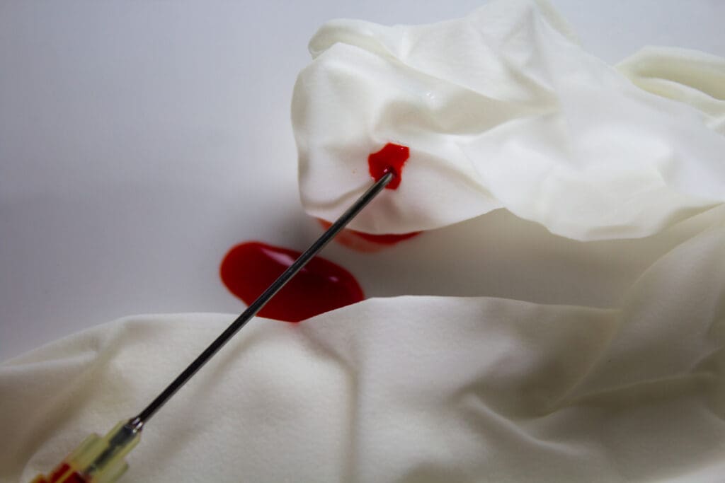 macro image injection needle with 07 mm diameter LIV Hospital