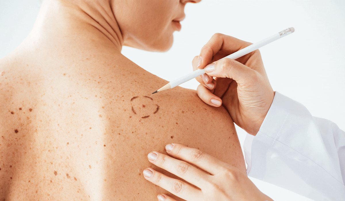 Why Are Some People More Susceptible to Cancer Than Others? Crucial