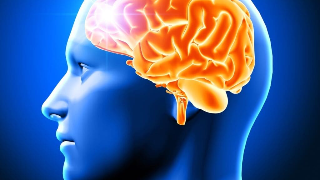 meningioma brain tumor