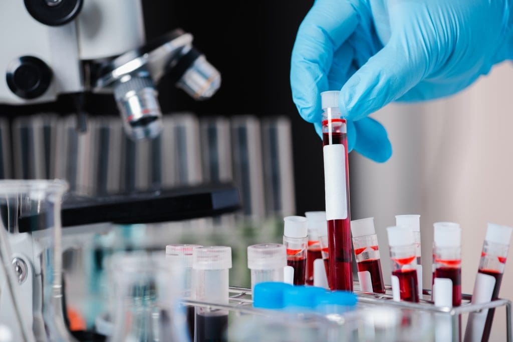 what can be mistaken for thalassemia