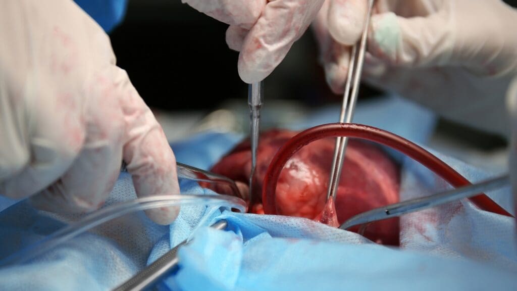 mitral valve replacement procedure